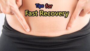 post c-section recovery tips